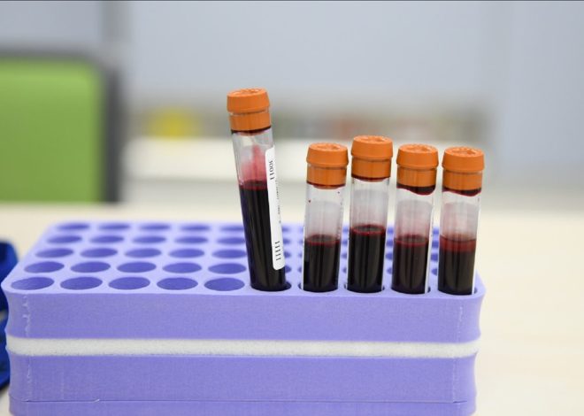 Новий стартап пропонує тестувати кров за допомогою ШІ