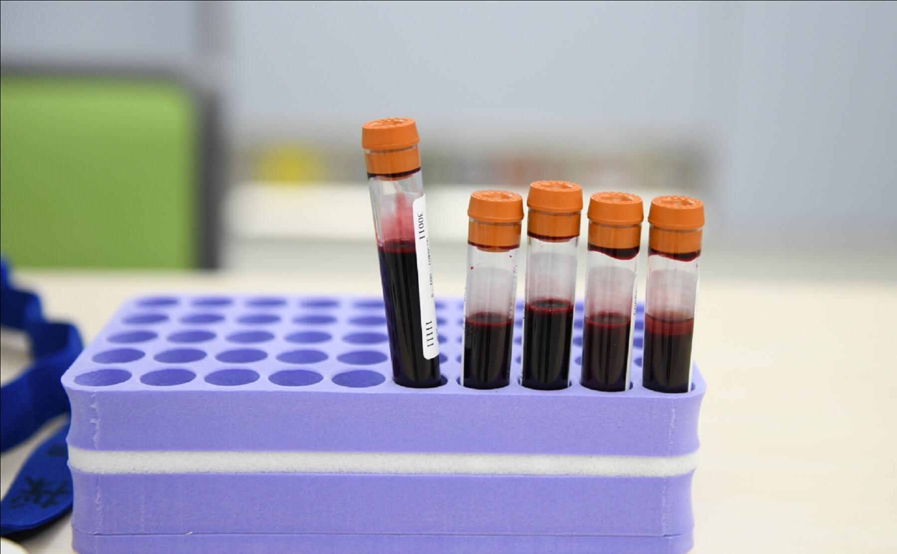 Новий стартап пропонує тестувати кров за допомогою ШІ