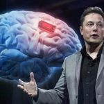 Neuralink випробує у Канаді свій мозковий чип: місцева влада дала дозвіл